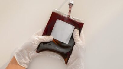 A doação de sangue é um simples gesto que pode salvar a vida de diversos pacientes, como os que passam por cirurgias, procedimentos oncológicos, transplantes e