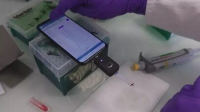 Teste rápido pode detectar Covid-19 via smartphone