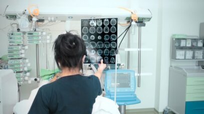 Conitec incorpora procedimento para tratar AVC pelo SUS