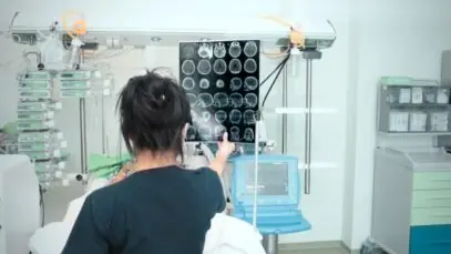 Conitec incorpora procedimento para tratar AVC pelo SUS