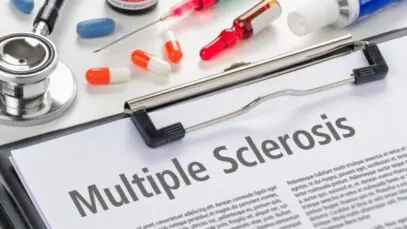 Nova opção de tratamento para esclerose chega ao SUS