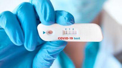 Testes da Covid-19 seguem em recuo nas farmácias
