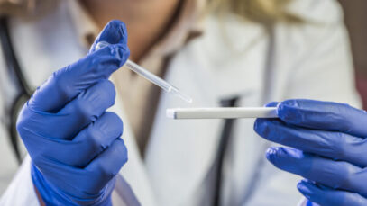 Liberação alfandegária atrasou entrega de testes de gripe