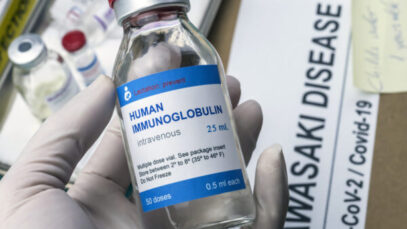 imunoglobulina