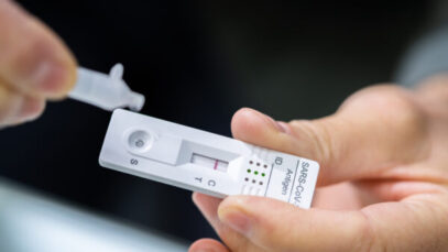 Anvisa libera venda de autotestes de Covid-19 no Brasil
