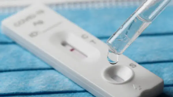 Testes Procura por testes de Covid-19 é cinco vezes maior e bate recorde
