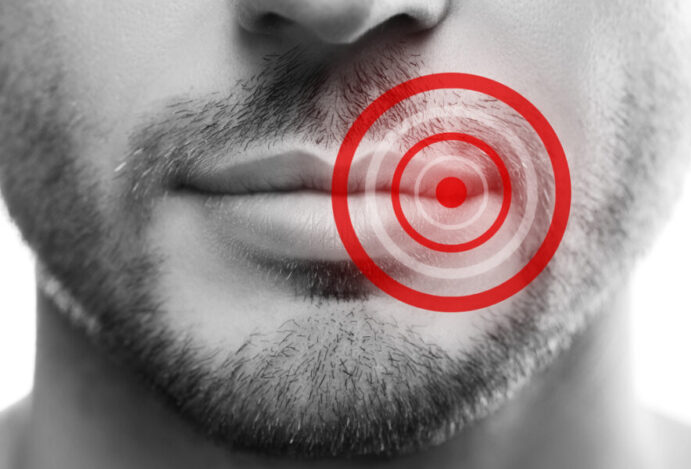Como curar a herpes labial rapidamente
