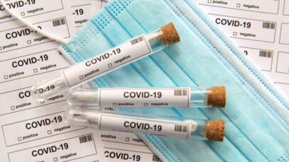 Casos da Covid em farmácias quadruplicam em um mês