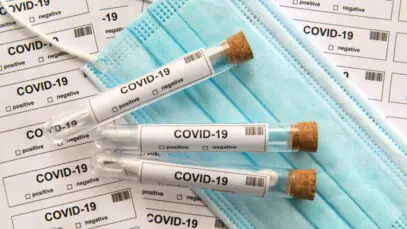 Casos da Covid em farmácias quadruplicam em um mês