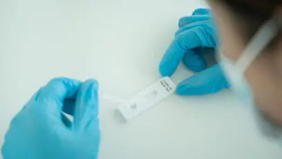 Testes positivos da Covid têm primeira queda em sete semanas