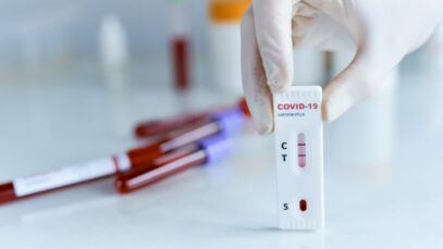 Testes positivos da Covid caem 32% em uma semana