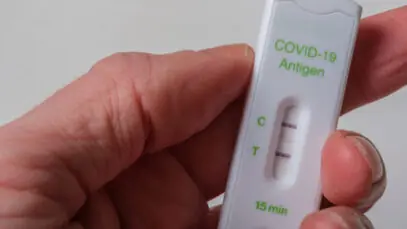 Casos de Covid em farmácias seguem acima de 30%
