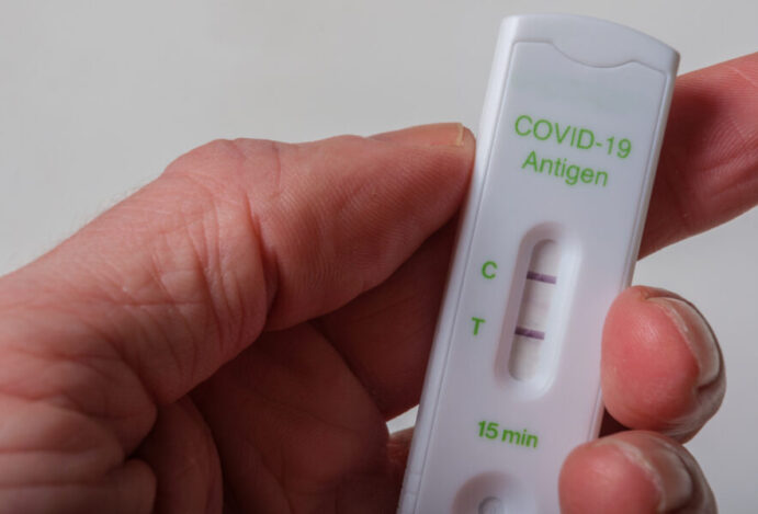 casos de Covid