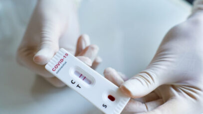 Percentual de testes positivos da covid já supera 30% em novembro
