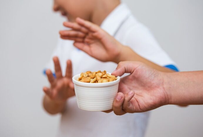 Alergia a alimentos