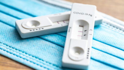 Casos de covid-19 caem em farmácias e laboratórios