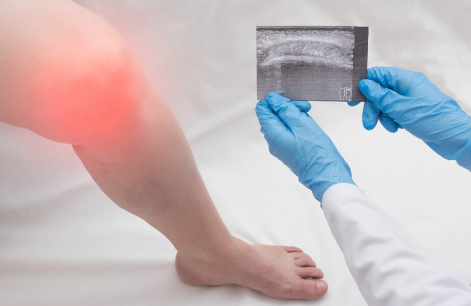 Artrose no joelho