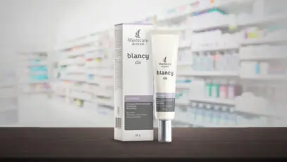 melasma