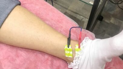 Bioimpedância