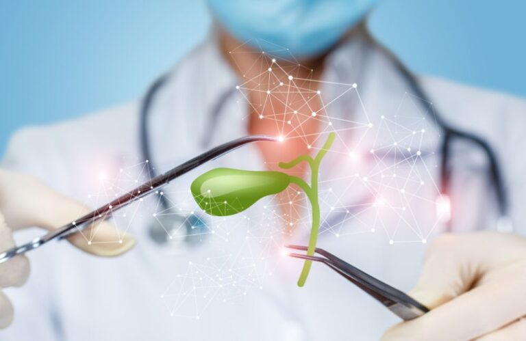 Quando é indicada a cirurgia de vesícula?