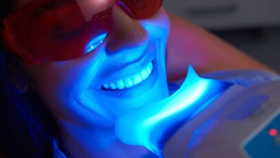 Como clarear os dentes