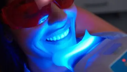 Como clarear os dentes