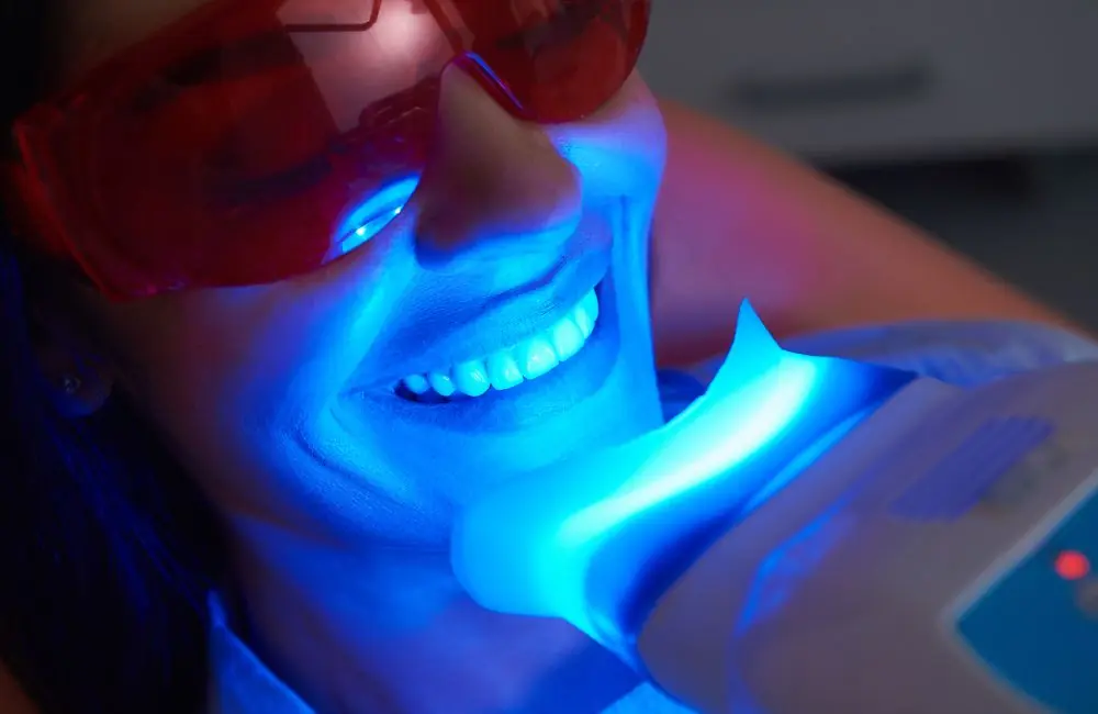 Como clarear os dentes Como clarear os dentes