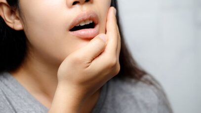 Alerta para os riscos da automedicação. Segundo a cirurgiã-dentista e especialista em saúde bucal Bruna Conde, muitas pessoas recorrem a essa prática para tratar problemas dentários como dores de dente, inflamações na gengiva e feridas na boca. No entanto, é importante lembrar que os medicamentos específicos para esses problemas dentários só devem ser prescritos e administrados por um profissional de saúde qualificado, como um dentista. Feridas e outros problemas que estimulam os riscos da automedicação 1. Feridas na boca - Aftas, herpes labial e outras lesões na boca podem causar dor e desconforto, levando as pessoas a buscar alívio por meio da automedicação. 2. Dores de dente - A dor de dente é um dos problemas mais comuns que levam as pessoas a buscar alívio imediato através da automedicação. As dores de dente podem ser causadas por cáries, infecções, inflamações, entre outros problemas. 3. Inflamação na gengiva - A gengivite é uma inflamação na gengiva que pode ser causada por uma higiene oral inadequada. Quando a inflamação causa dor ou desconforto, muitas pessoas recorrem à automedicação para alívio. 4. Sensibilidade dentária - A sensibilidade dentária é uma condição que causa dor ou desconforto quando os dentes são expostos a estímulos como alimentos quentes, frios, ácidos ou açúcar. As pessoas podem tentar tratar a sensibilidade dentária através da automedicação. 5. Halitose - A halitose, ou mau hálito, é uma condição que pode ser causada por uma variedade de fatores, incluindo higiene oral inadequada, cáries, doenças gengivais, entre outros. As pessoas podem tentar tratar o mau hálito através da automedicação. Fazer o uso de medicamentos de forma indevida, podem até mesmo mascarar o problema, dificultando o diagnóstico e tratamento adequados. Além disso, podem também criar uma resistência do organismo aquela medicação, fazendo com que perca o efeito desejado. A resistência a medicamentos pode levar a uma redução da eficácia do tratamento e à necessidade de utilizar medicamentos mais potentes e caros, além de aumentar o risco de efeitos colaterais e complicações. Por isso, é fundamental que os medicamentos sejam utilizados apenas sob orientação médica, respeitando a dose e o tempo de uso recomendados. A automedicação pode ser perigosa, pois os medicamentos podem causar efeitos colaterais e interagir com outros medicamentos que a pessoa já esteja tomando. Além disso, algumas pessoas podem ter alergias a determinados medicamentos, o que pode resultar em uma reação alérgica grave. “Ao contrário do que muitas pessoas pensam, a visita regular ao dentista não deve ser vista apenas como uma necessidade para tratar problemas já existentes. Na verdade, é recomendado que se faça visitas também, para exames preventivos, com o objetivo de identificar problemas dentários em estágios iniciais, antes que se tornem mais graves e mais difíceis de tratar.” esclarece Bruna. O dentista também pode orientar quanto a melhor forma de manter a higiene bucal e prevenir problemas dentários. “É importante ressaltar que o dentista é o profissional mais indicado para tratar problemas dentários e prescrever medicamentos específicos para cada caso. A automedicação pode agravar o problema e dificultar o tratamento adequado. Consulte sempre um dentista antes de tomar qualquer medicamento para problemas dentários, pois somente um profissional qualificado pode indicar o tratamento mais adequado para cada caso específico”, finaliza.