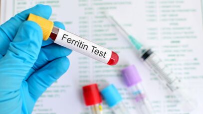 Ferritina