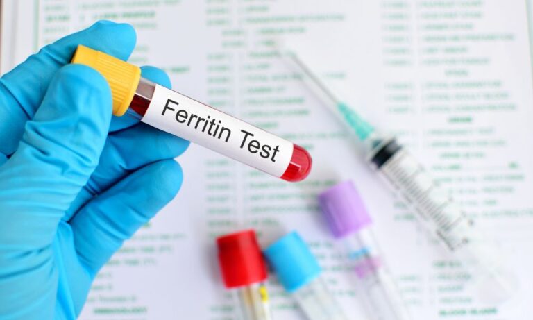 Exame de ferritina, para que serve?