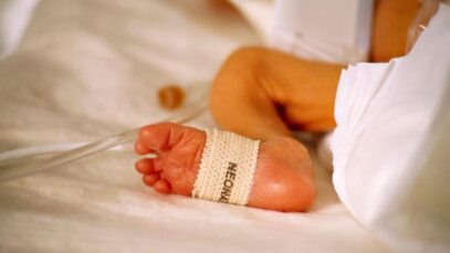 icterícia neonatal