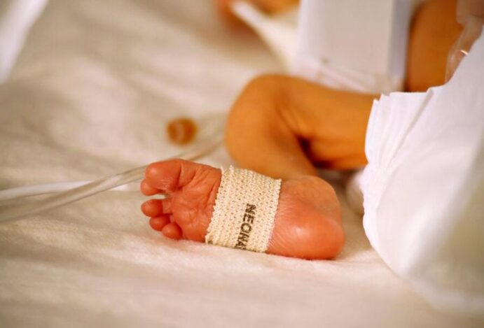 icterícia neonatal