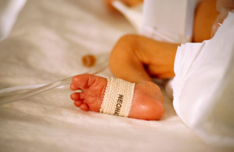 Como diagnosticar a icterícia neonatal e como é feito o tratamento?