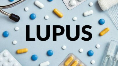 lúpus