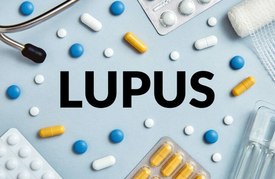 lúpus