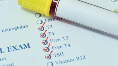Testes de tireoide