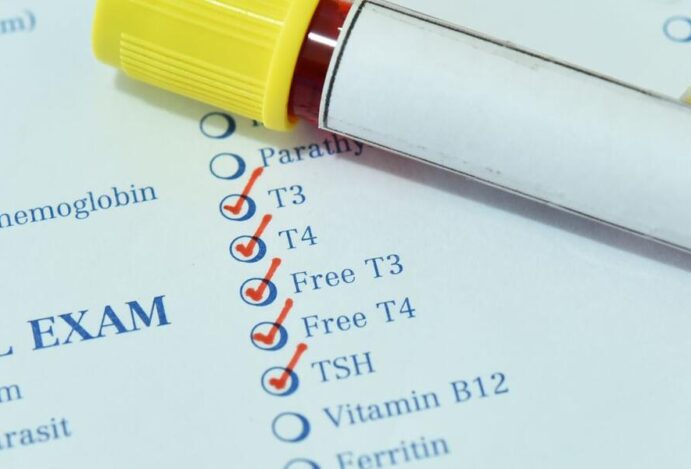 Testes de tireoide
