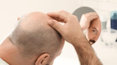 Minoxidil