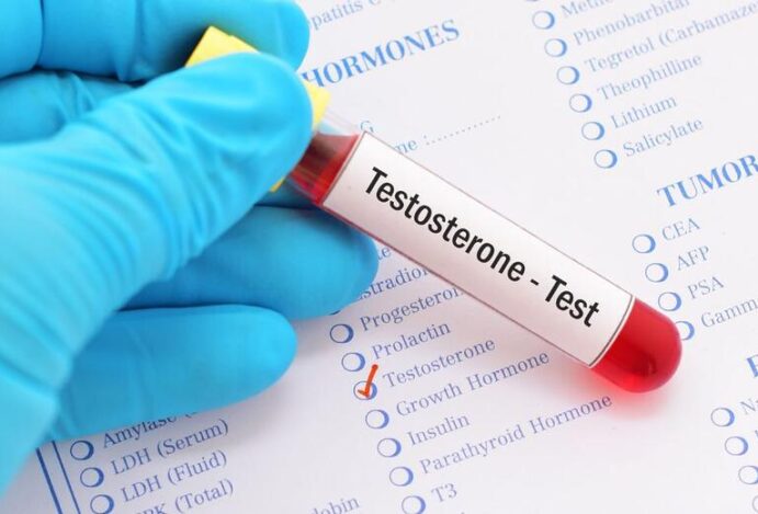 Testosterona