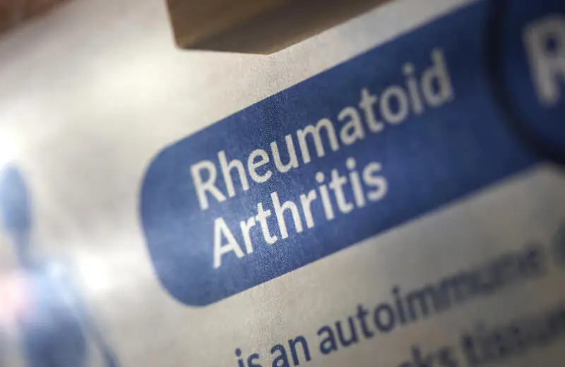 artrite reumatoide artrite reumatoide