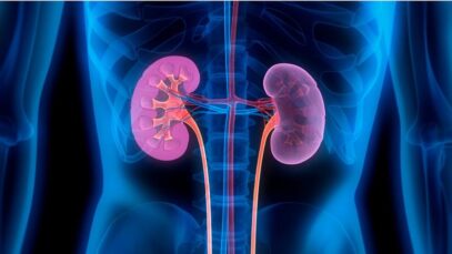 Brasil ganha medicamento para diabéticos tipo 2 com DRC