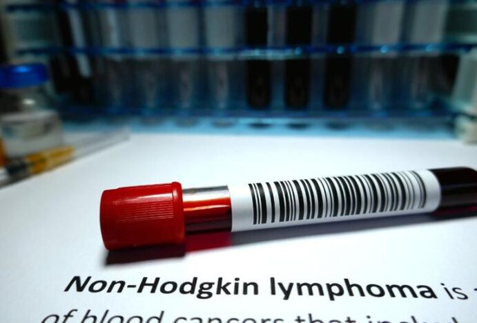 Linfoma