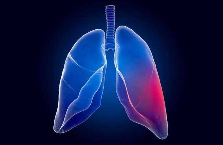 Uma visão completa da fibrose cística: o que é, sintomas e tratamento