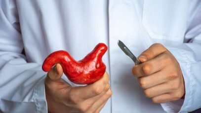 Cirurgia bariátrica