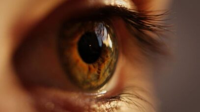 celulite ocular
