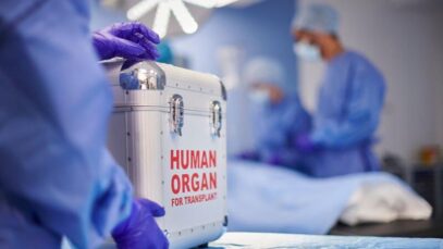 Transplante de órgãos