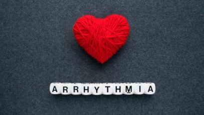 arritmia cardíaca