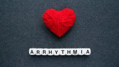 arritmia cardíaca
