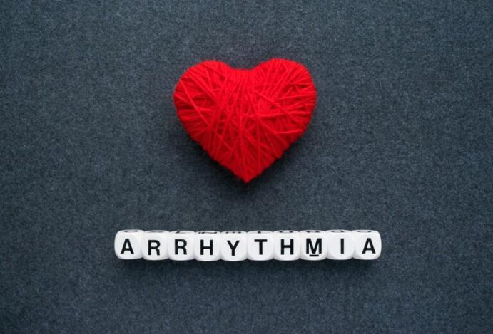 arritmia cardíaca