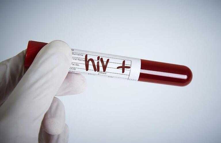 Compreendendo o HIV: como prevenir, como tratar e o que fazer